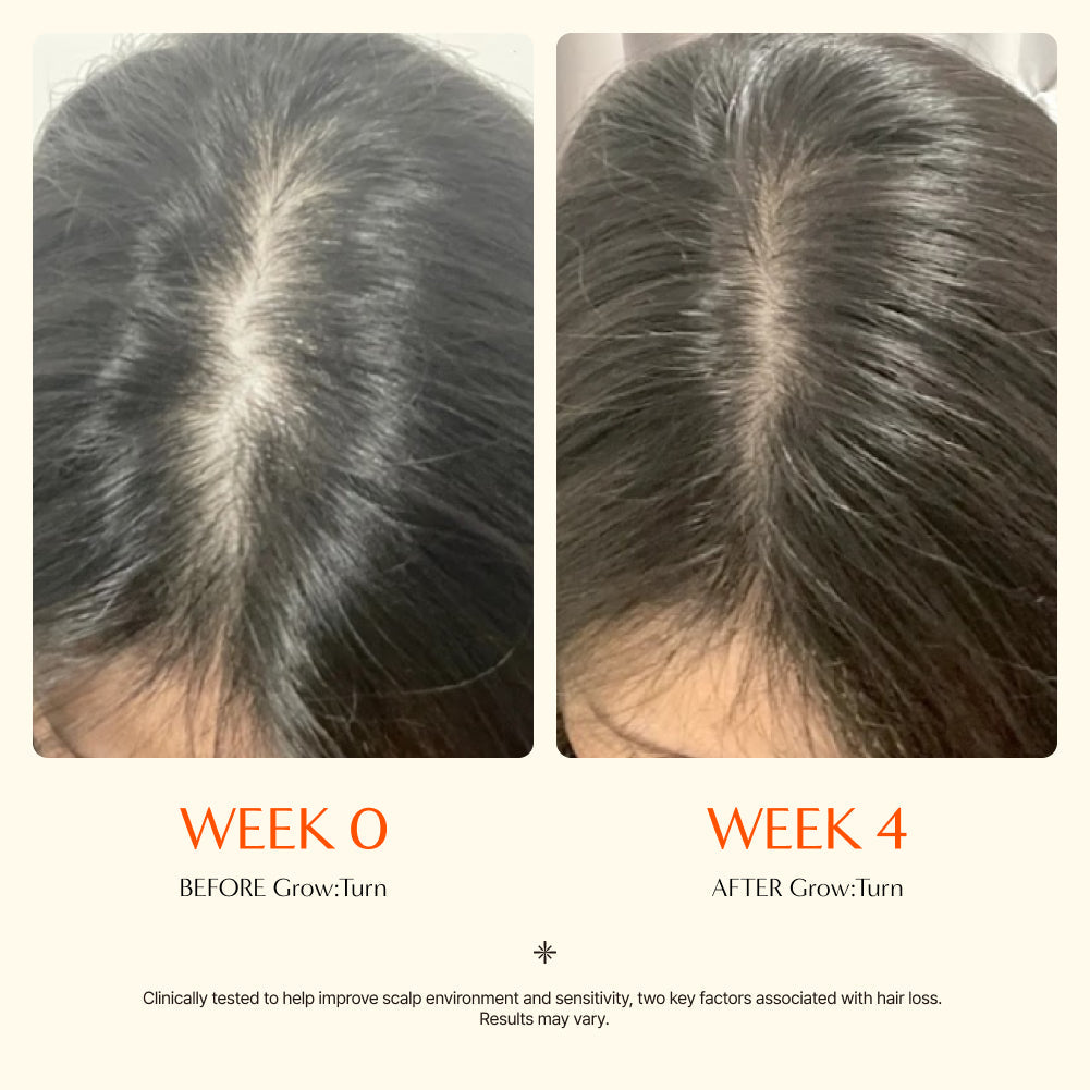 lilyeve hair growth serum